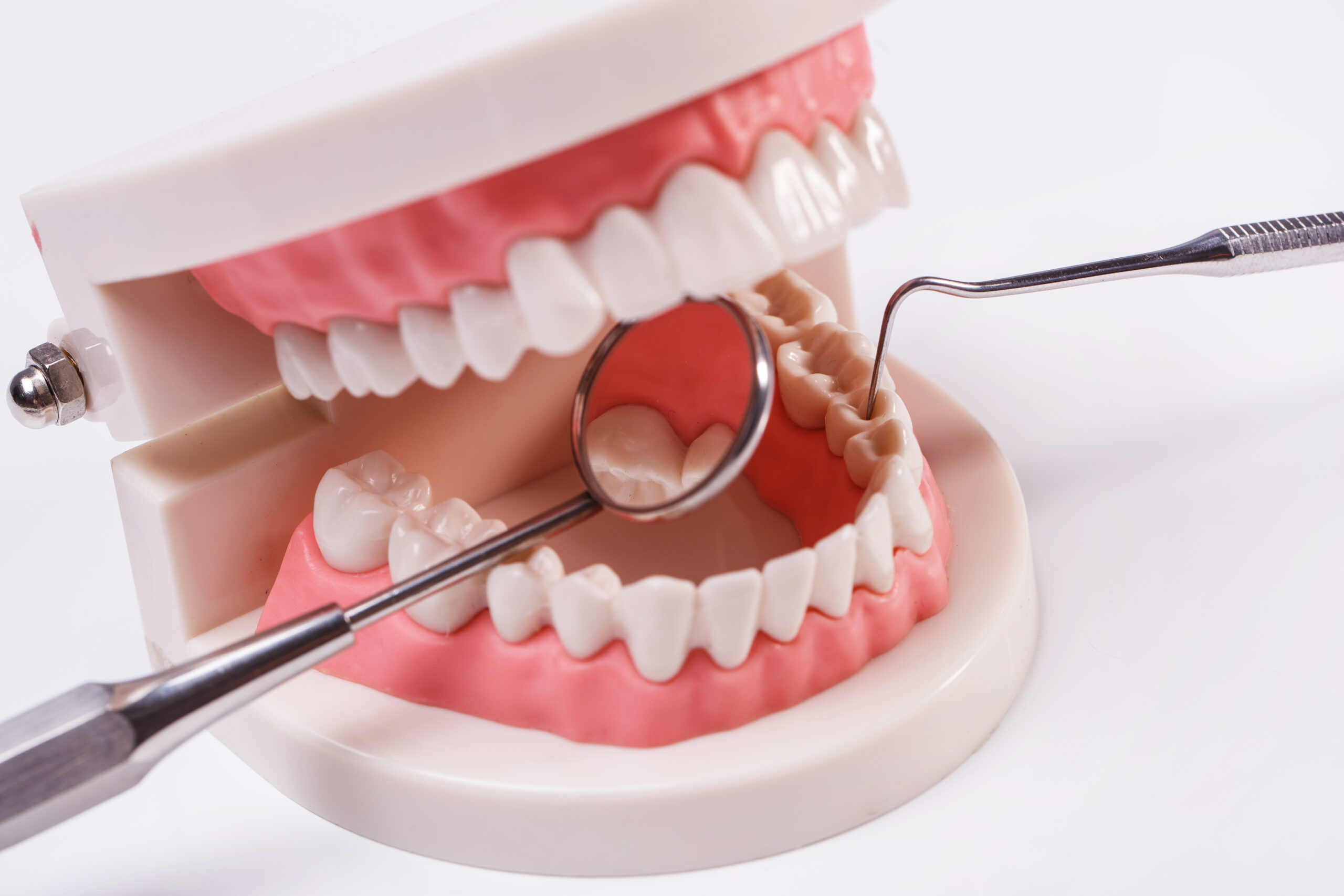 Почему важно заботиться о зубных имплантатах как о настоящих зубах